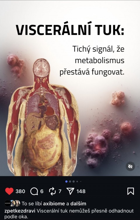 IG infografika pro zpetkezdravi