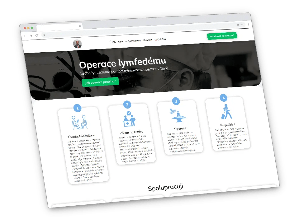 Operace lymfedému web